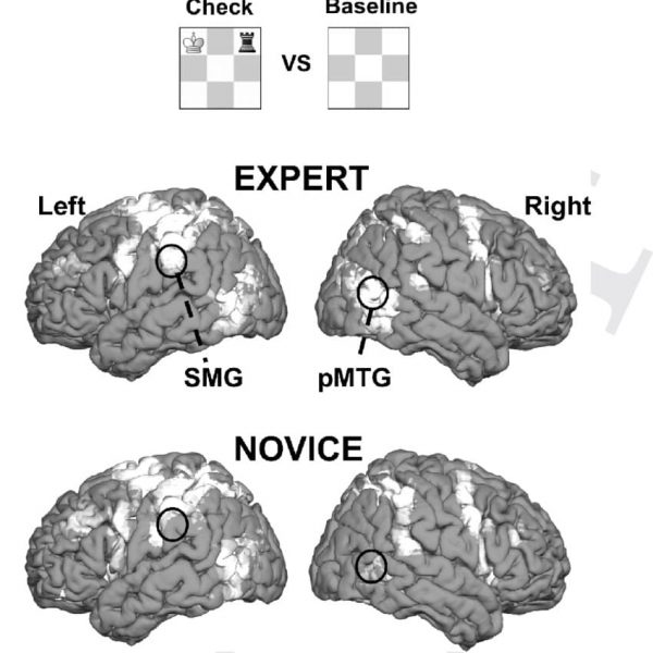 chess players brain